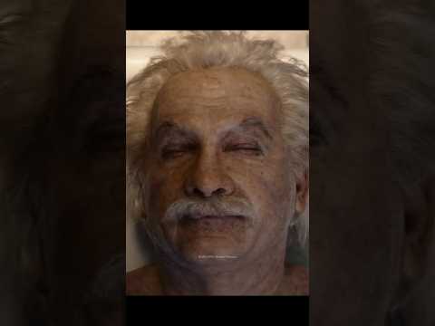 where is Albert Einstein brain ?